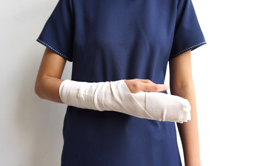 Person wearing a sling supporting an injured arm in bandage